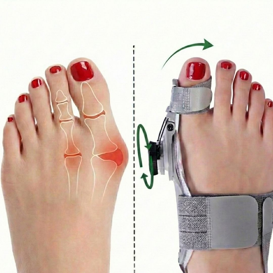 ToeFlex Pro - Supports Bunion Correction & Foot Wellness
